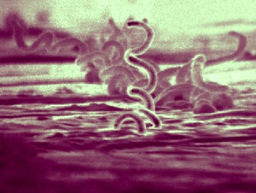 Treponema Palladum Spirochetes